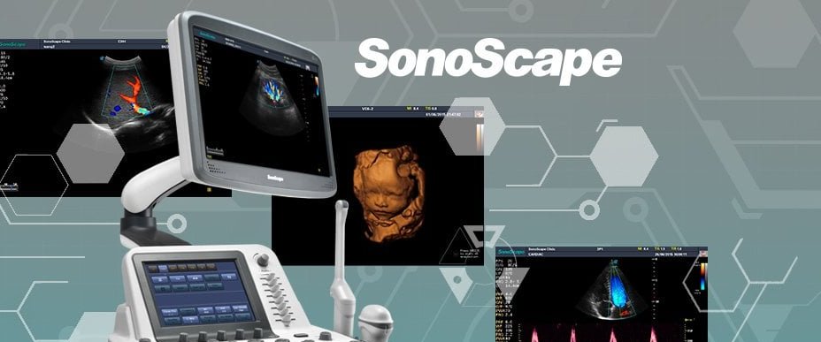 Sonoscape echografie echografie ultrasoon systeem echotoestel